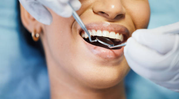 Best Emergency Dental Services for Seniors in Hamilton, MO